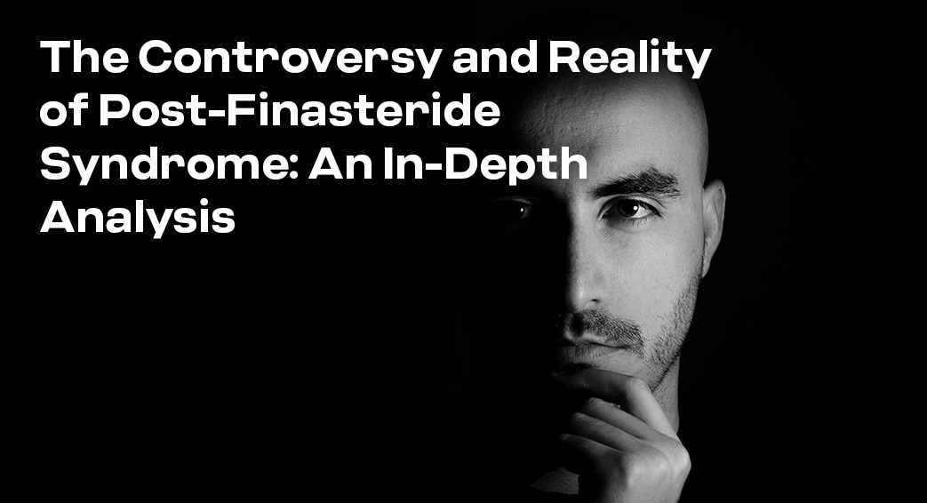 The Controversy and Reality of Post-Finasteride Syndrome: An In-Depth Analysis
