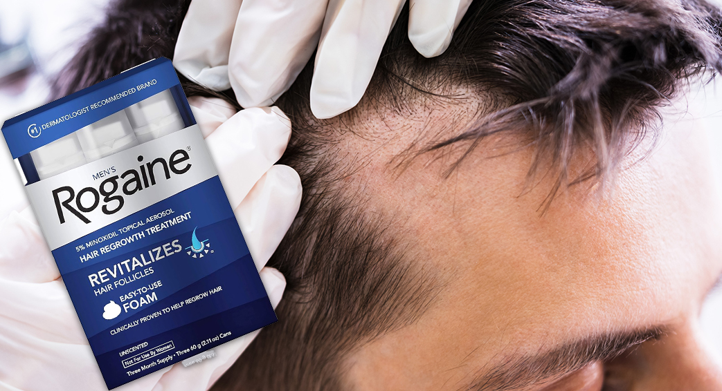 The Truth About Rogaine (Topical Minoxidil): What You Need to Know Before You Start